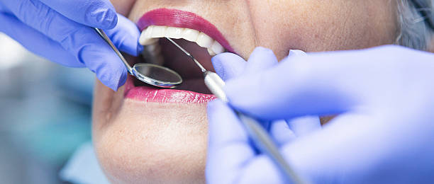 Best Emergency Tooth Extraction in Liberty, SC