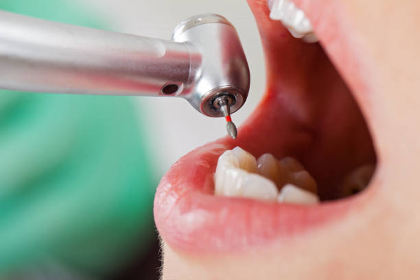 Best Emergency Gum Treatment in Liberty, SC
